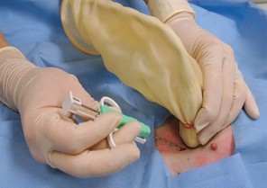 Interventional Radiology